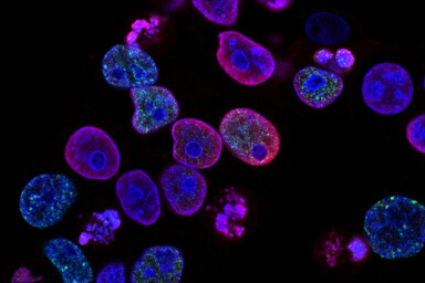 Cihaz Hizmetlerimiz diagnostic lab case gallery 6